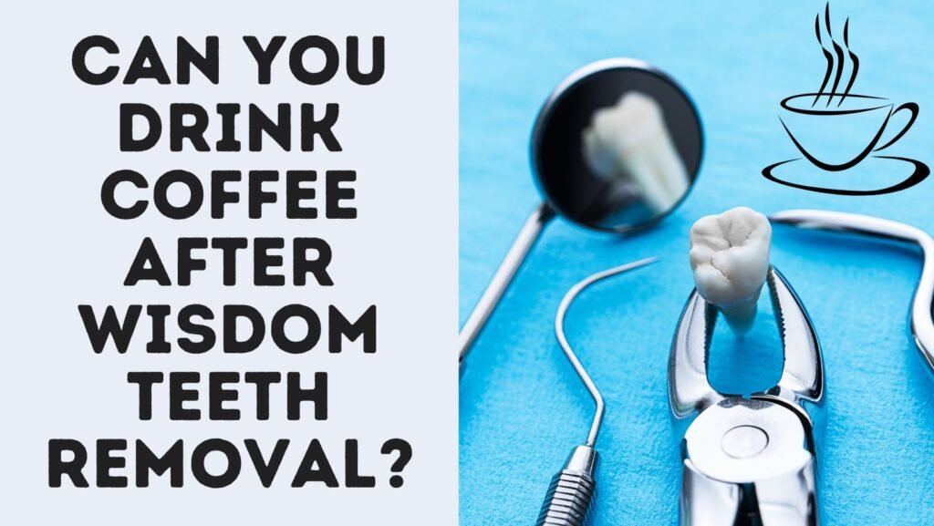 Can You Drink Coffee After Wisdom Teeth Removal?